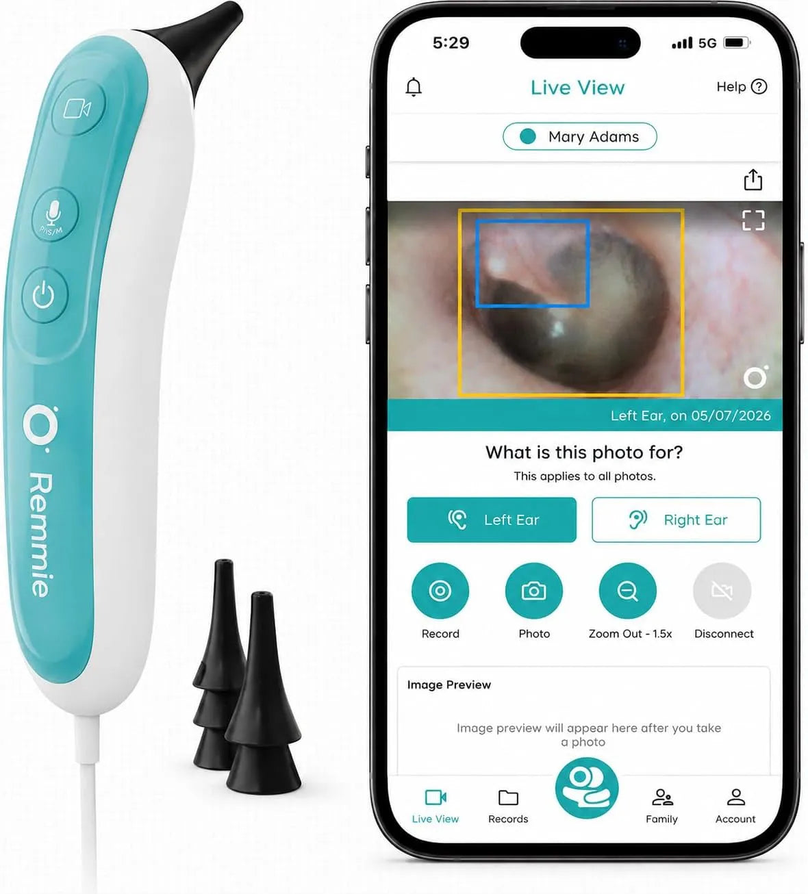 Remmie 4 otoscopes intelligents alimentés par l'IA